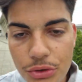 Hebahnon